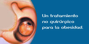 GRAFICO QUE EXPLICA COMO SE PONE EL BALON INTRAGASTRICO