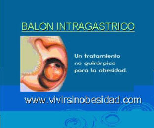 BALON INTRAGASTRICO - TRATAMIENTO NO QUIRURGICO PARA LA OBESIDAD