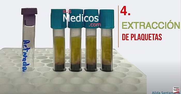 tubos de ensayo con plasma rico en plaquetas
